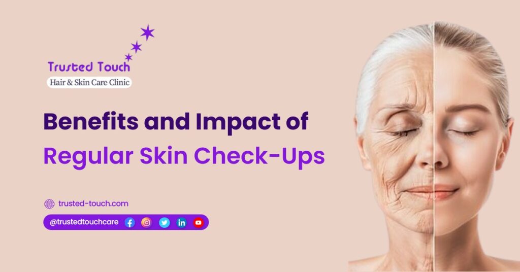 Benefits and Impact of Regular Skin Check-ups